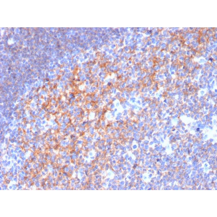 Immunohistochemistry (formalin-fixed, paraffin-embedded) - Anti-CD19 Antibody [CD19/3116] (CF®568) (A354242) - Antibodies.com