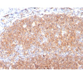 Immunohistochemistry (formalin-fixed, paraffin-embedded) - Anti-CD19 Antibody [CD19/3117] (CF®647) (A354250) - Antibodies.com