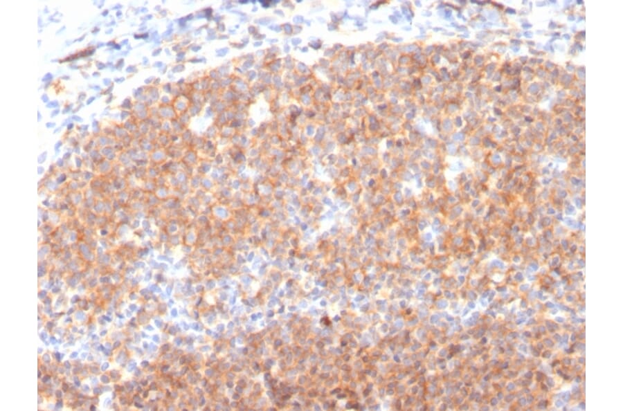 Immunohistochemistry (formalin-fixed, paraffin-embedded) - Anti-CD19 Antibody [CD19/3117] (CF®647) (A354250) - Antibodies.com