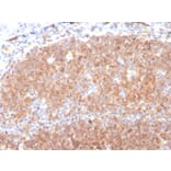 Immunohistochemistry (formalin-fixed, paraffin-embedded) - Anti-CD19 Antibody [CD19/3117] (CF®568) (A354251) - Antibodies.com