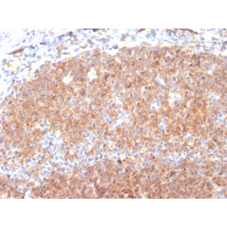 Immunohistochemistry (formalin-fixed, paraffin-embedded) - Anti-CD19 Antibody [CD19/3117] (CF®740) (A354252) - Antibodies.com