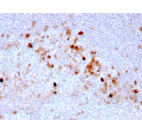 Immunohistochemistry (formalin-fixed, paraffin-embedded) - Anti-CD105 Antibody [ENG/3269] (CF®405S) (A354280) - Antibodies.com
