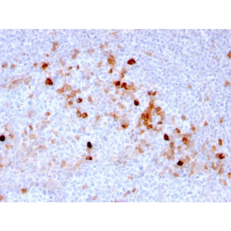 Immunohistochemistry (formalin-fixed, paraffin-embedded) - Anti-CD105 Antibody [ENG/3269] (CF®405S) (A354280) - Antibodies.com