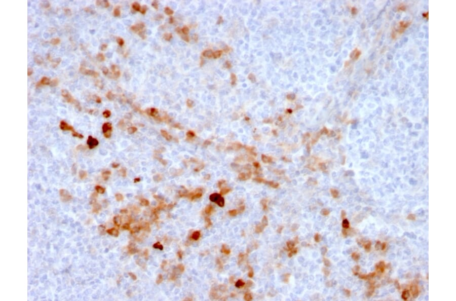 Immunohistochemistry (formalin-fixed, paraffin-embedded) - Anti-CD105 Antibody [ENG/3269] (CF®647) (A354282) - Antibodies.com