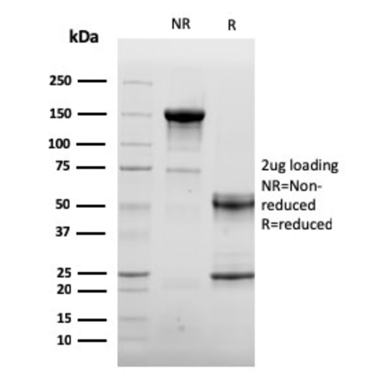 SDS-PAGE - Anti-CD105 Antibody [ENG/3269] (CF®647) (A354282) - Antibodies.com