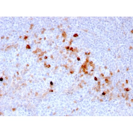 Immunohistochemistry (formalin-fixed, paraffin-embedded) - Anti-CD105 Antibody [ENG/3269] (CF®568) (A354283) - Antibodies.com