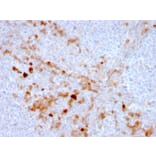 Immunohistochemistry (formalin-fixed, paraffin-embedded) - Anti-CD105 Antibody [ENG/3269] (CF®740) (A354284) - Antibodies.com