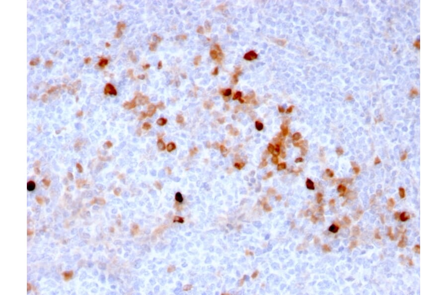 Immunohistochemistry (formalin-fixed, paraffin-embedded) - Anti-CD105 Antibody [ENG/3269] (CF®488A) (A354285) - Antibodies.com