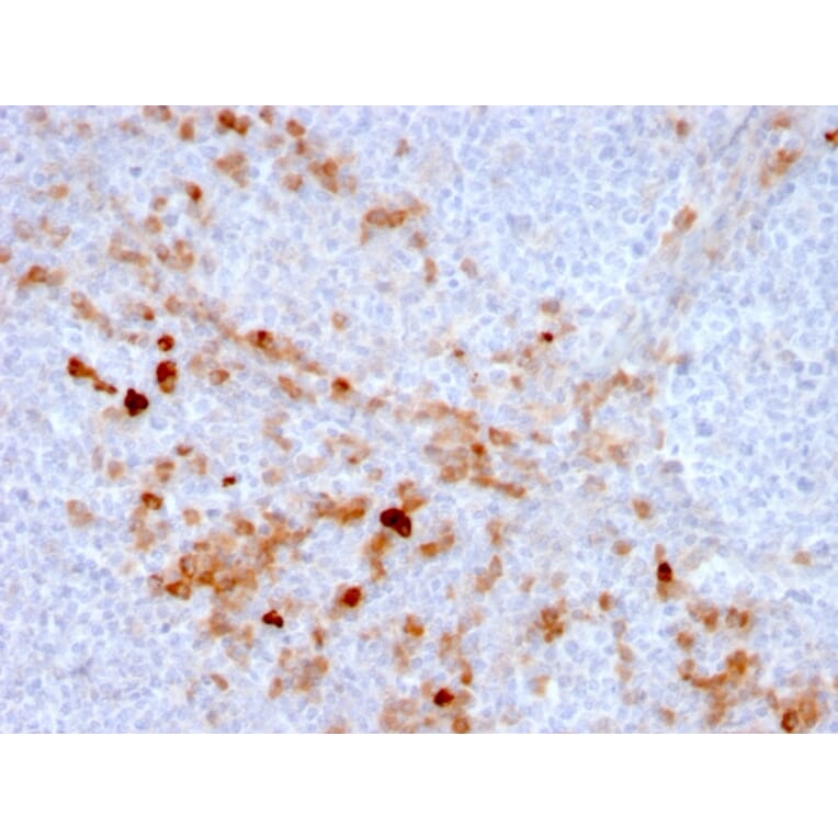 Immunohistochemistry (formalin-fixed, paraffin-embedded) - Anti-CD105 Antibody [ENG/3269] (CF®488A) (A354285) - Antibodies.com