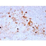 Immunohistochemistry (formalin-fixed, paraffin-embedded) - Anti-CD105 Antibody [ENG/3269] (CF®594) (A354286) - Antibodies.com