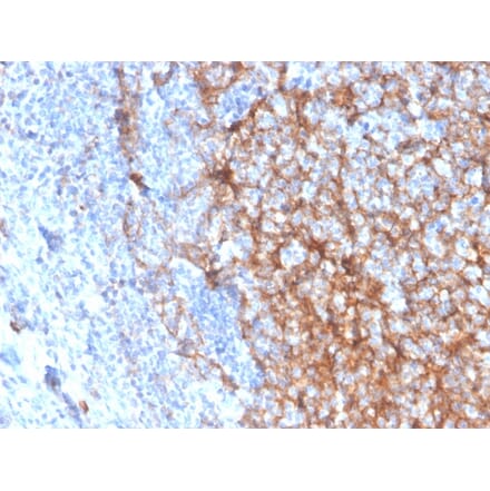 Immunohistochemistry (formalin-fixed, paraffin-embedded) - Anti-CD11b Antibody [ITGAM/3337] (CF®640R) (A354289) - Antibodies.com