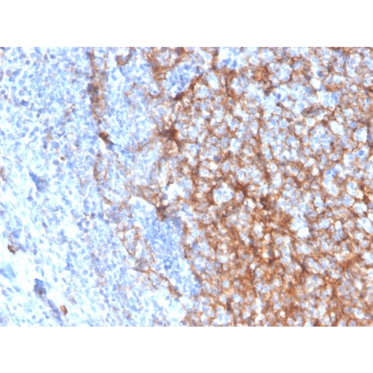 Immunohistochemistry (formalin-fixed, paraffin-embedded) - Anti-CD11b Antibody [ITGAM/3337] (CF®647) (A354290) - Antibodies.com