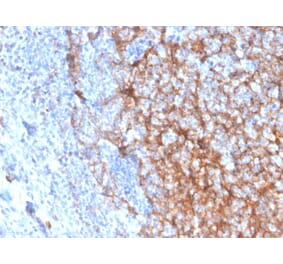 Immunohistochemistry (formalin-fixed, paraffin-embedded) - Anti-CD11b Antibody [ITGAM/3337] (CF®594) (A354294) - Antibodies.com