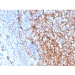 Immunohistochemistry (formalin-fixed, paraffin-embedded) - Anti-CD11b Antibody [ITGAM/3337] (Biotin) (A354295) - Antibodies.com