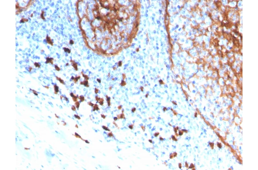 Immunohistochemistry (formalin-fixed, paraffin-embedded) - Anti-CD11b Antibody [ITGAM/3339] (CF®405S) (A354304) - Antibodies.com