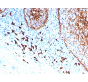 Immunohistochemistry (formalin-fixed, paraffin-embedded) - Anti-CD11b Antibody [ITGAM/3339] (CF®647) (A354306) - Antibodies.com