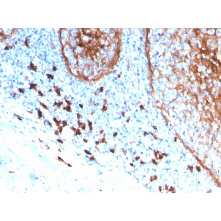 Immunohistochemistry (formalin-fixed, paraffin-embedded) - Anti-CD11b Antibody [ITGAM/3339] (CF®488A) (A354309) - Antibodies.com