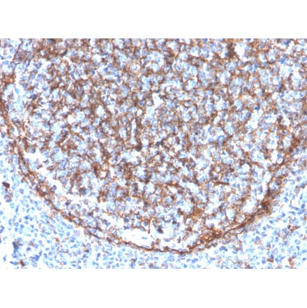Immunohistochemistry (formalin-fixed, paraffin-embedded) - Anti-CD11b Antibody [ITGAM/3340] (CF®640R) (A354313) - Antibodies.com