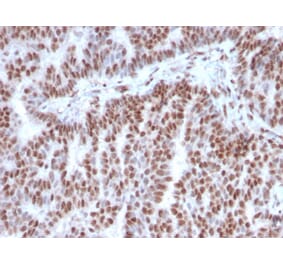 Immunohistochemistry (formalin-fixed, paraffin-embedded) - Anti-Estrogen Receptor alpha Antibody [ESR1/3342] (CF®405S) (A354320) - Antibodies.com
