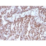 Immunohistochemistry (formalin-fixed, paraffin-embedded) - Anti-Estrogen Receptor alpha Antibody [ESR1/3342] (CF®488A) (A354325) - Antibodies.com