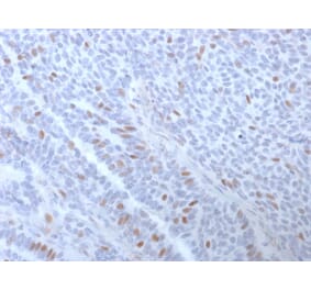 Immunohistochemistry (formalin-fixed, paraffin-embedded) - Anti-Estrogen Receptor alpha Antibody [ESR1/3373] (CF®405S) (A354328) - Antibodies.com