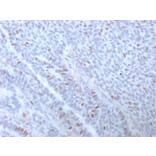 Immunohistochemistry (formalin-fixed, paraffin-embedded) - Anti-Estrogen Receptor alpha Antibody [ESR1/3373] (CF®740) (A354332) - Antibodies.com