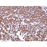Immunohistochemistry (formalin-fixed, paraffin-embedded) - Anti-CD20 Antibody [MS4A1/3409] (CF®640R) (A354337) - Antibodies.com