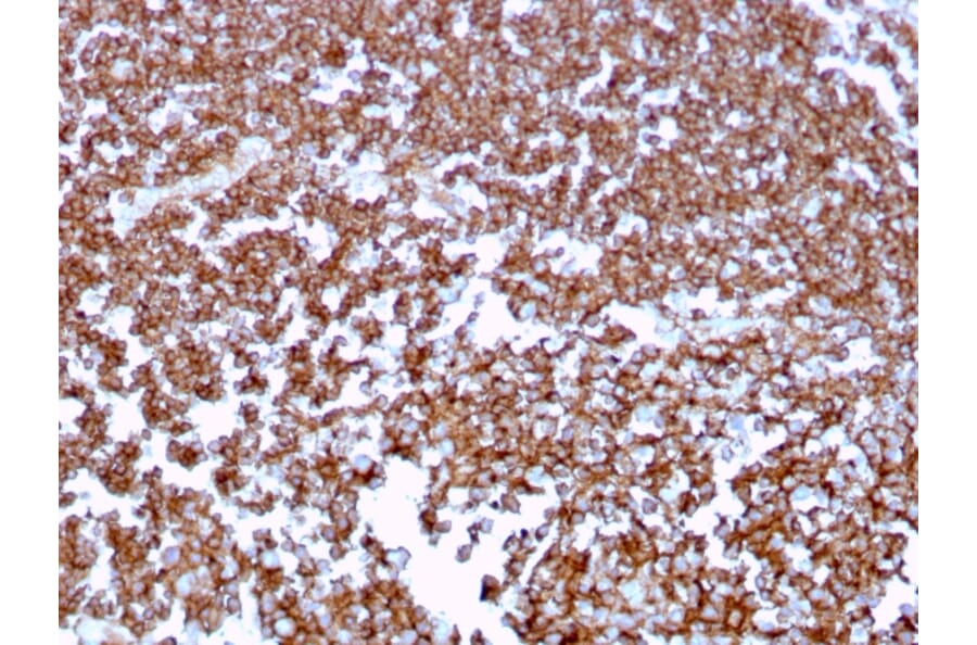 Immunohistochemistry (formalin-fixed, paraffin-embedded) - Anti-CD20 Antibody [MS4A1/3409] (CF®647) (A354338) - Antibodies.com