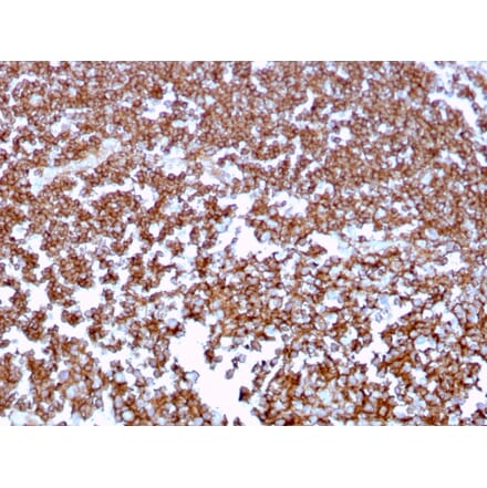 Immunohistochemistry (formalin-fixed, paraffin-embedded) - Anti-CD20 Antibody [MS4A1/3409] (CF®568) (A354339) - Antibodies.com