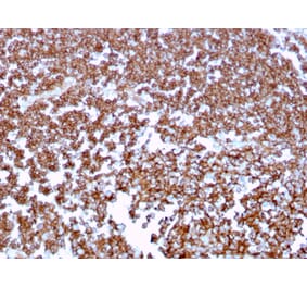 Immunohistochemistry (formalin-fixed, paraffin-embedded) - Anti-CD20 Antibody [MS4A1/3409] (CF®488A) (A354341) - Antibodies.com