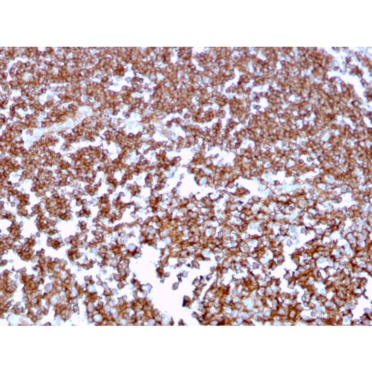 Immunohistochemistry (formalin-fixed, paraffin-embedded) - Anti-CD20 Antibody [MS4A1/3409] (CF®488A) (A354341) - Antibodies.com