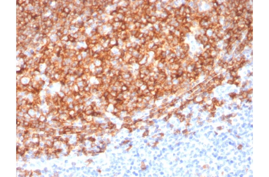 Immunohistochemistry (formalin-fixed, paraffin-embedded) - Anti-CD20 Antibody [MS4A1/3410] (CF®405S) (A354344) - Antibodies.com