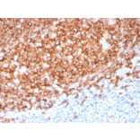 Immunohistochemistry (formalin-fixed, paraffin-embedded) - Anti-CD20 Antibody [MS4A1/3410] (CF®640R) (A354345) - Antibodies.com