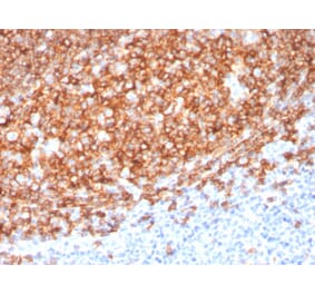 Immunohistochemistry (formalin-fixed, paraffin-embedded) - Anti-CD20 Antibody [MS4A1/3410] (CF®594) (A354350) - Antibodies.com