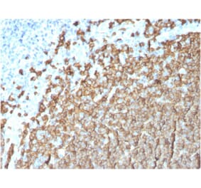 Immunohistochemistry (formalin-fixed, paraffin-embedded) - Anti-CD20 Antibody [MS4A1/3411] (CF®640R) (A354353) - Antibodies.com
