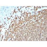 Immunohistochemistry (formalin-fixed, paraffin-embedded) - Anti-CD20 Antibody [MS4A1/3411] (CF®640R) (A354353) - Antibodies.com