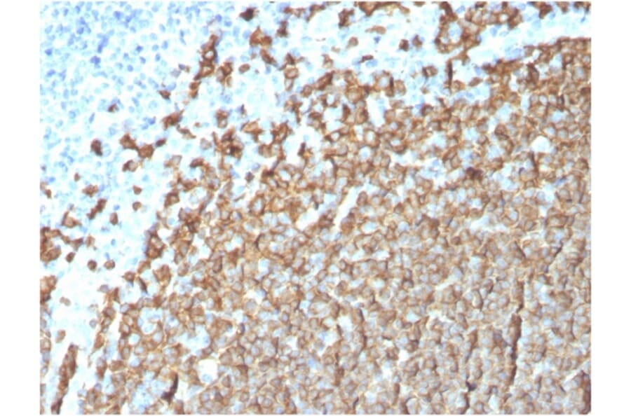 Immunohistochemistry (formalin-fixed, paraffin-embedded) - Anti-CD20 Antibody [MS4A1/3411] (CF®647) (A354354) - Antibodies.com