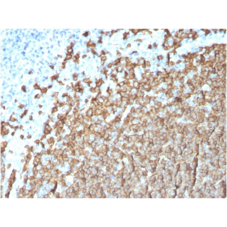 Immunohistochemistry (formalin-fixed, paraffin-embedded) - Anti-CD20 Antibody [MS4A1/3411] (CF®488A) (A354357) - Antibodies.com