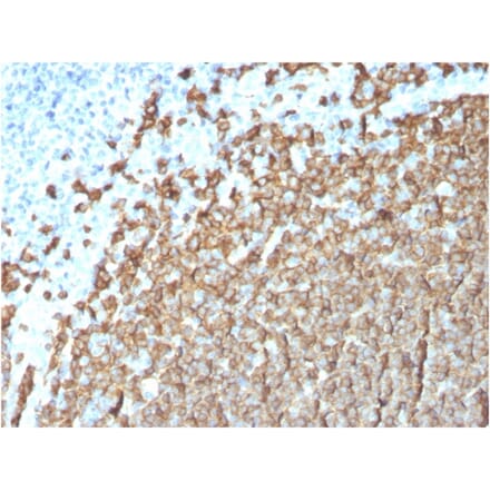 Immunohistochemistry (formalin-fixed, paraffin-embedded) - Anti-CD20 Antibody [MS4A1/3411] (Biotin) (A354359) - Antibodies.com