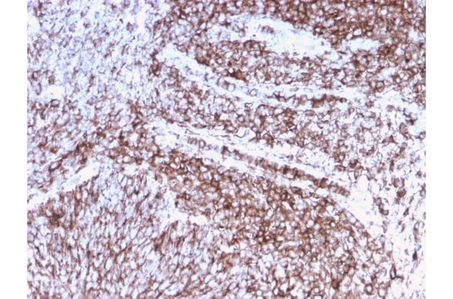 Immunohistochemistry (formalin-fixed, paraffin-embedded) - Anti-CD44 Antibody [rHCAM/918] (CF®405S) (A354360) - Antibodies.com