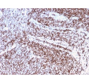 Immunohistochemistry (formalin-fixed, paraffin-embedded) - Anti-CD44 Antibody [rHCAM/918] (CF®640R) (A354361) - Antibodies.com