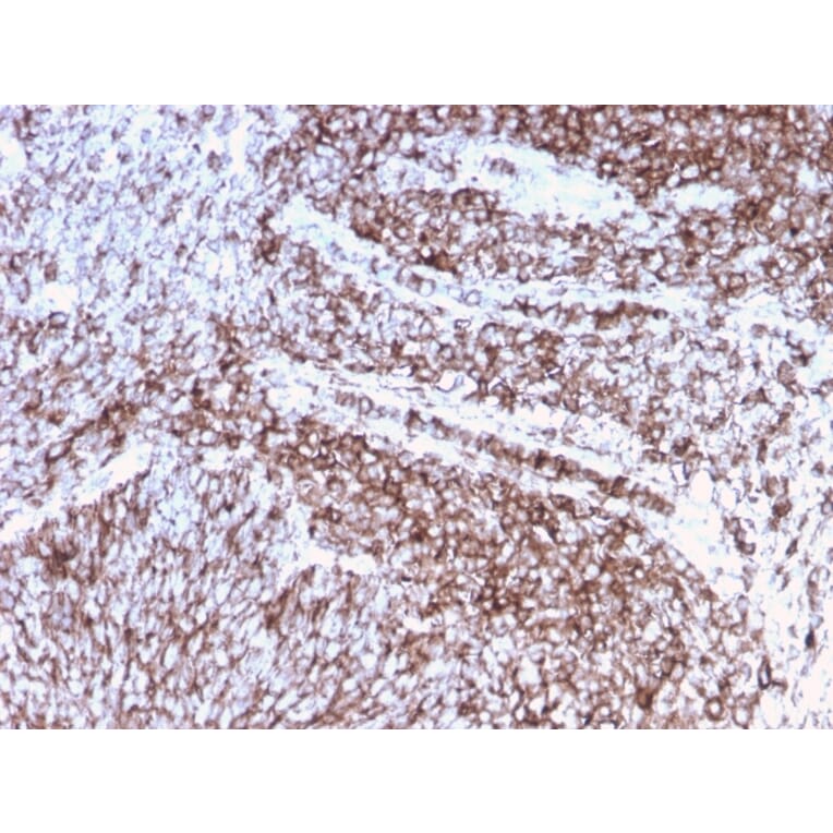 Immunohistochemistry (formalin-fixed, paraffin-embedded) - Anti-CD44 Antibody [rHCAM/918] (CF®740) (A354364) - Antibodies.com