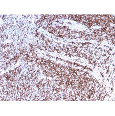 Immunohistochemistry (formalin-fixed, paraffin-embedded) - Anti-CD44 Antibody [rHCAM/918] (CF®488A) (A354365) - Antibodies.com