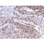 Immunohistochemistry (formalin-fixed, paraffin-embedded) - Anti-CD44 Antibody [rHCAM/918] (CF®488A) (A354365) - Antibodies.com