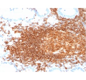 Immunohistochemistry (formalin-fixed, paraffin-embedded) - Anti-CD45RB Antibody [rPTPRC/1132] (CF®405S) (A354368) - Antibodies.com