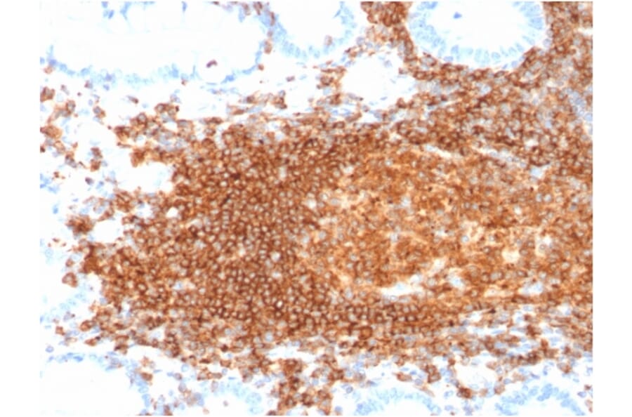 Immunohistochemistry (formalin-fixed, paraffin-embedded) - Anti-CD45RB Antibody [rPTPRC/1132] (CF®405S) (A354368) - Antibodies.com