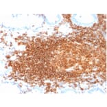 Immunohistochemistry (formalin-fixed, paraffin-embedded) - Anti-CD45RB Antibody [rPTPRC/1132] (CF®640R) (A354369) - Antibodies.com