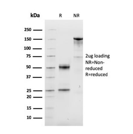 SDS-PAGE - Anti-Cyclin D1 Antibody [CCND1/3548] (CF®740) (A354380) - Antibodies.com
