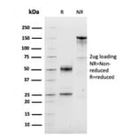 SDS-PAGE - Anti-Cyclin D1 Antibody [CCND1/3548] (CF®488A) (A354381) - Antibodies.com