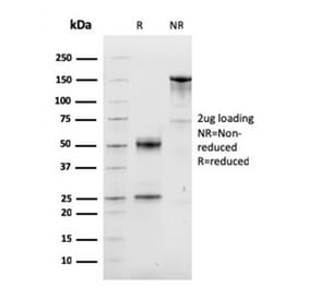 SDS-PAGE - Anti-Cyclin D1 Antibody [CCND1/3548] (CF®594) (A354382) - Antibodies.com